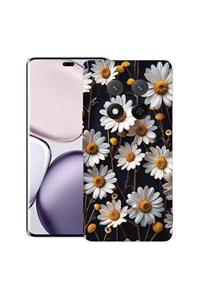 bestcase ¬Æ Husa pentru Honor Magic 7 Lite, Premium Slim Silicon 1.2MM, 3D Da...