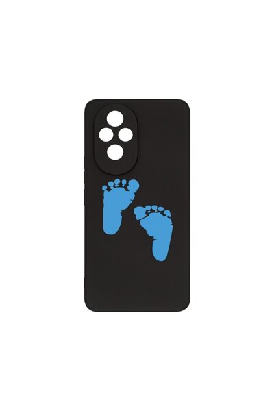 bestcase Θήκη Σιλικόνης Premium, Συμβατή με Honor 200 Pro, Σχέδιο Πατούσες Αγ...