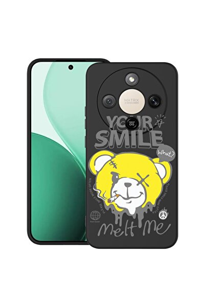 bestcase Ултра тънък TPU калъф, съвместим с Honor Magic8 Lite, Мече: Твоята у...