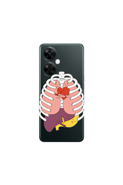 Other Oneplus Nord CE 3 Lite 5G Anatomy Transparent Silicone TPU Θήκη