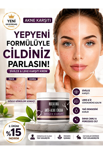 Rozalina Rise كريم مضاد للبثور يحتوي على الفيتامينات، كريم للوجه مضاد للرؤوس ...