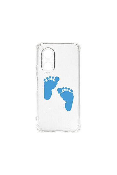 bestcase Αντικραδασμική Θήκη 1.5mm, Συμβατή με Huawei Nova 9 SE, Σχέδιο Ποδιώ...