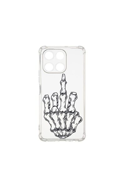 bestcase Αντικραδασμική Θήκη 1.5MM, Συμβατή με Honor X6a, Σχέδιο Σκελετωμένου...