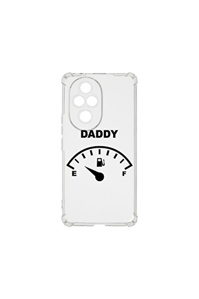 bestcase Husa Αντικραδασμική 1.5MM, συμβατή με Honor 200 Pro, Daddy's Life, Τ...