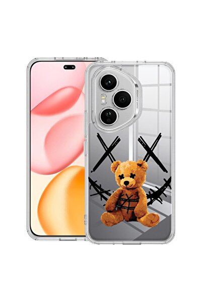 bestcase Прозрачен силиконов калъф за Honor 400 Pro, Усмивка на плюшено мече,...