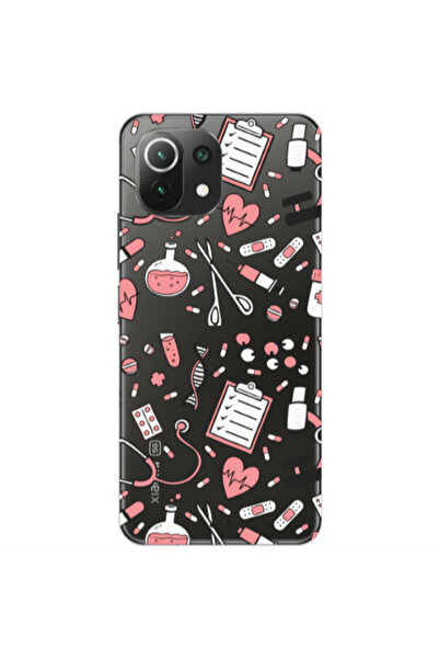 Other Xiaomi Mi 11 Lite Laboratory Transparent Silicone TPU Θήκη