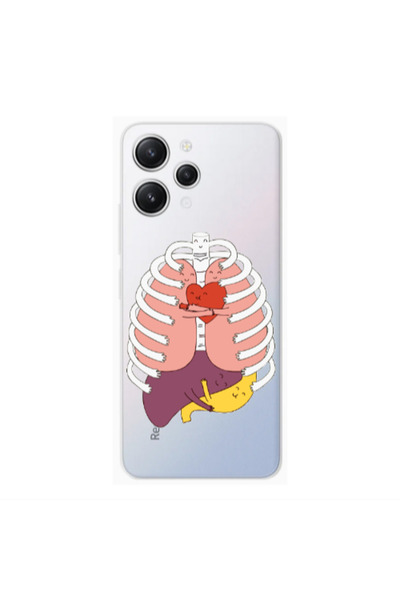 Other Xiaomi Redmi 12 Anatomy Transparent Silicone TPU Θήκη