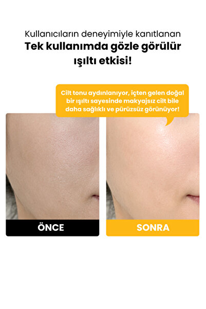 FRANKLY Sunday Glow Radiance, %5 Niacinamide ve Glutathion İçeren Aydınlatıcı Kağıt Maske