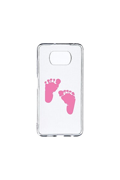 bestcase Прозрачен силиконов калъф 2ММ, съвместим с Xiaomi Poco X3 Pro / Poco...