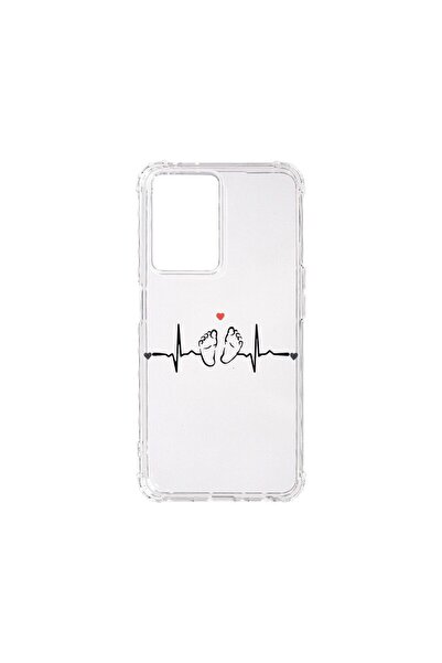 bestcase Αντικραδασμική Θήκη 1.5MM, Συμβατή με OPPO A57 4G / A57 5G, My Littl...