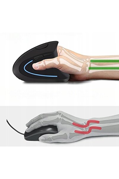 NO BRAND Qxvnm Mouse wireless ergonomic Mouse Bluetooth Mouse vertical