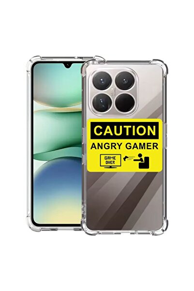 bestcase Αντικραδασμική Θήκη Συμβατή με Xiaomi 17, με Σχέδιο Angry Gamer, Ενι...
