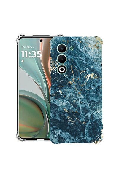 bestcase Калъф за Xiaomi Redmi 15 5G (169 мм) с мраморен дизайн - зелен и зла...