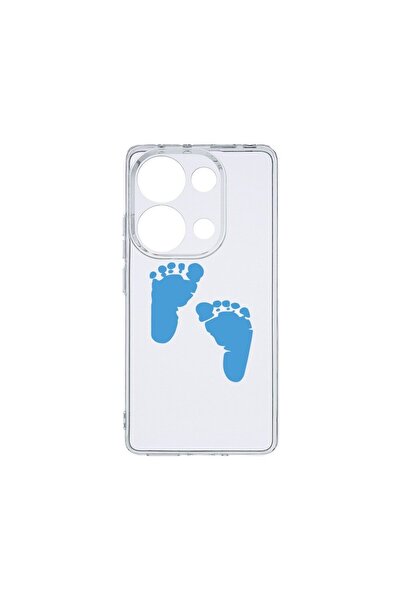 bestcase Husa BestCase¬Æ Clear Silicon 2MM, Compatibila Cu Xiaomi Redmi Note ...