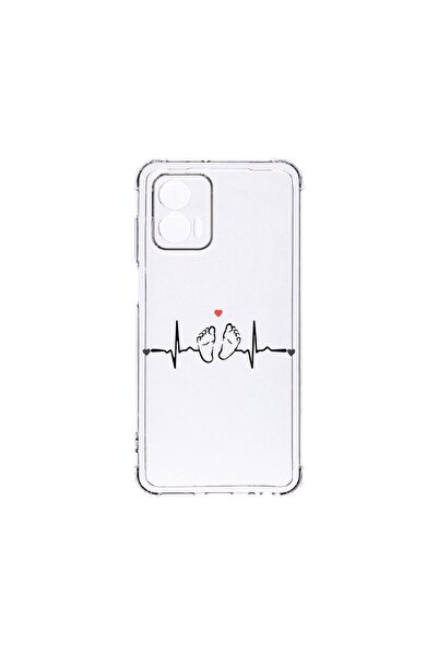 bestcase ¬Æ Husa Anti Shock 1.5MM, Compatibila Cu Motorola Edge 50 Fusion, My...