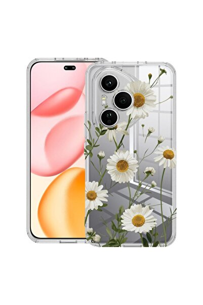 bestcase ¬Æ Husa Anti Shock Compatibila cu Honor 400 Pro, Floral - Daisy, 205...