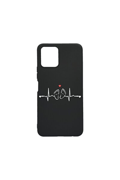 bestcase Λεπτή Θήκη Σιλικόνης 0.8MM, Συμβατή με Motorola Moto G50 με Πλαϊνό Α...