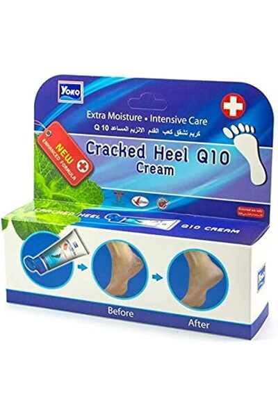 YOKO كريم Q10 لعلاج تشققات الكعب، 50 جرام