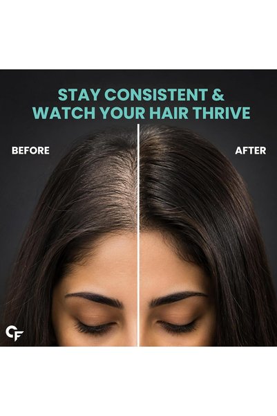 Carbamide Forte Biotin 2500mcg for Hair Growth | Biotin Supplement for hair, skin, and nails | Hair Vitamins for Men & Women | 120 Tablets