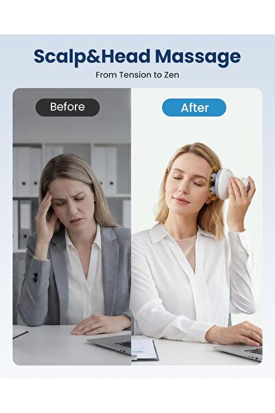 Arabest Hair Massager, Scalp Massage Tool for Relaxation and Hair Growth