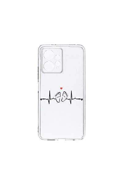 bestcase Husa BestCase¬Æ Clear Silicon 2MM, Compatibila Cu Xiaomi Redmi Note ...