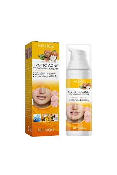 EELHOE Cystic Acne Removal Cream – Antibacterial Soothing Moisturizer, Suppor...