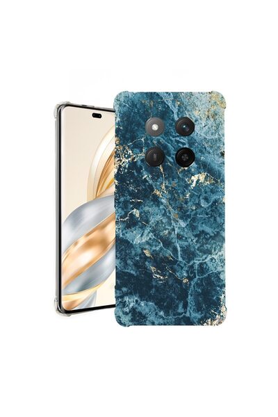 bestcase Калъф за Honor Magic7 Lite, Удароустойчив 1.5ММ, Мраморен - Зелен и ...