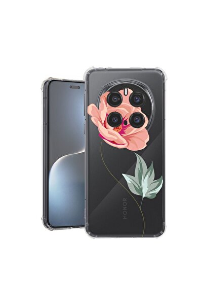 bestcase Θήκη για Honor Magic7 Pro, Αντικραδασμική 1.5MM, Ροζ, Προστασία κάμε...