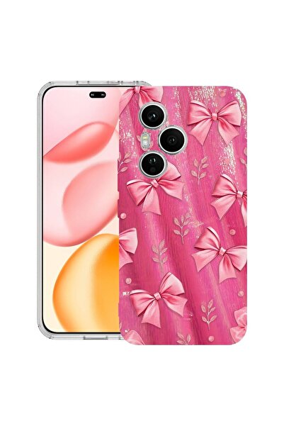 bestcase Αντικραδασμική Θήκη Συμβατή με Honor 400 Pro, Χαριτωμένο Σχέδιο, 205...