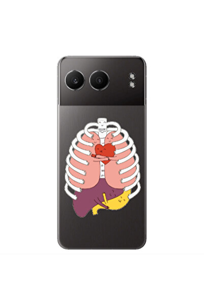 Other Oneplus Nord 4 Anatomy Transparent Silicone TPU Θήκη