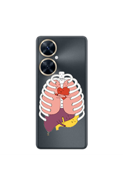 Other Huawei Nova 11i Anatomy Transparent Silicone TPU Θήκη