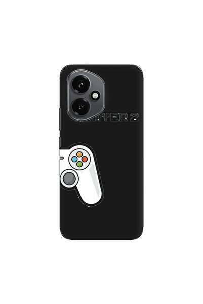 Other Honor Magic 400 Player 2 Black Colored Silicone TPU Θήκη