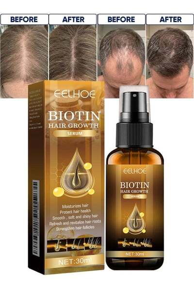 EELHOE Biotin Hair Growth Serum Spray, Anti Hair Loss Treatment with Sodium P...