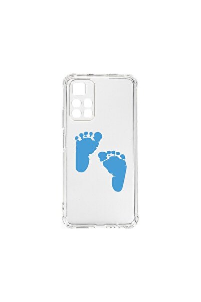 bestcase Husa BestCase¬Æ Anti Shock 1.5MM, Compatibila Cu Xiaomi Poco M4 Pro ...
