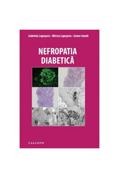 Editura Callisto Nefropatia Diabetica