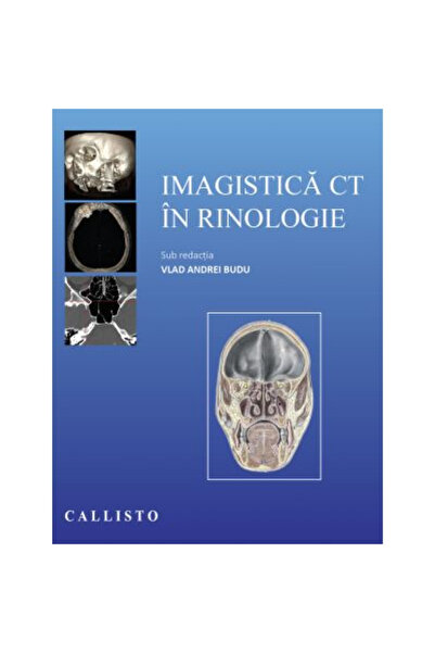 Editura Callisto Imagistica CT in rinologie