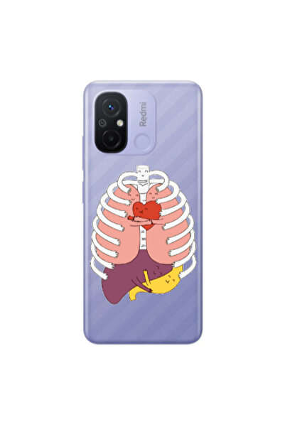 Other Xiaomi Redmi 12C Anatomy Transparent Silicone TPU Θήκη
