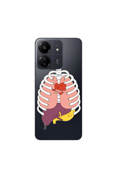 Other Xiaomi Redmi 13C Anatomy Transparent Silicone TPU Θήκη