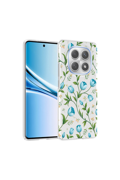 noktaks حافظة متوافقة مع هاتف Redmi Note 15 4G مع غطاء مشبك منقوش لحماية الكا...