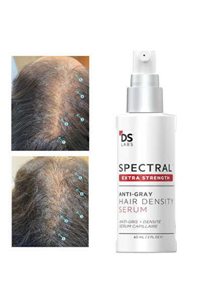GYB Ser Spectral Extra Puternic Fortifiant cu Nanoxidil 7% – Tratament Avansa...