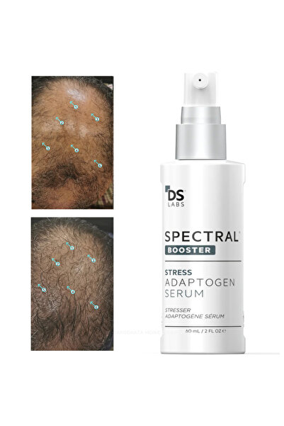 GYB Ser Spectral Booster, Anti-Stres împotriva căderii părului, stimulează să...