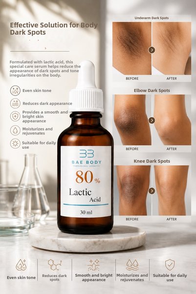 baebody 80% Lactic Acid Peeling Solution 30 ml – Professional Chemical Peeling Against Darkening of Armpits, Knees, Elbows, and Body, Skin Tone Equalizing and Renewing Care