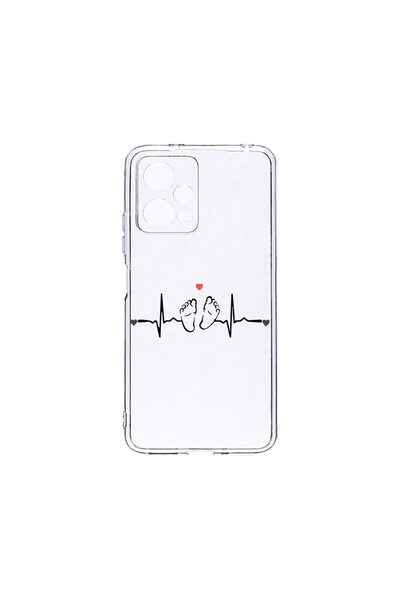 bestcase Husa BestCase¬Æ Clear Silicon 2MM, Compatibila Cu Xiaomi Redmi Note ...