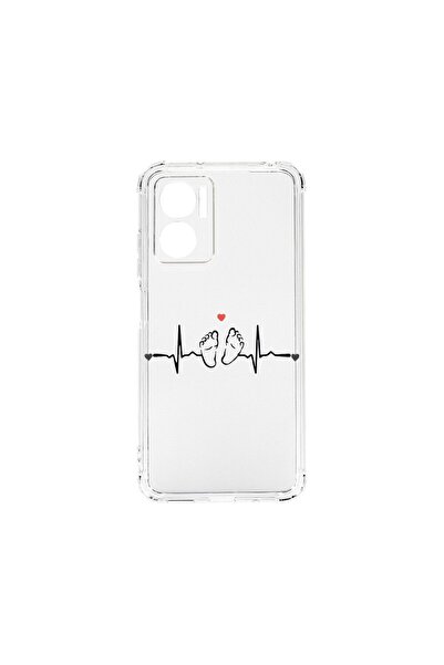 bestcase Αντικραδασμική Θήκη 1.5mm, Συμβατή με Xiaomi Redmi 10 5G, My Little ...
