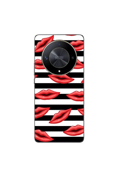 OEM Θήκη συμβατή με Honor Magic6 Lite από σιλικόνη gel TPU με σχέδιο ριγέ φιλιά