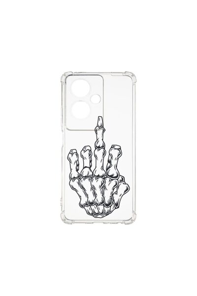 bestcase ¬Æ Husa Anti Shock 1.5MM, Compatibila Cu OPPO Reno 11F, Skeleton Han...