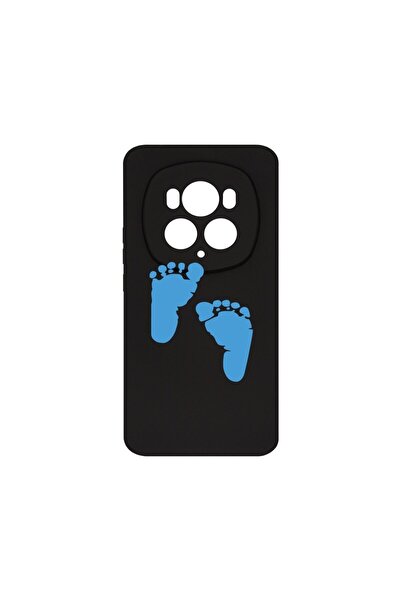 bestcase Θήκη Σιλικόνης Premium, Συμβατή με Honor Magic6 Pro, Σχέδιο Πατηματι...