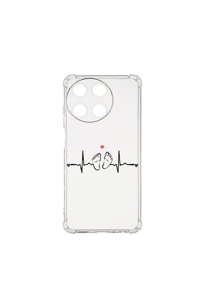 bestcase Αντικραδασμική Θήκη 1.5MM, Συμβατή με Realme 11 4G, My Little Love, ...