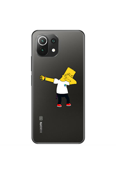 Other Xiaomi Mi 11 Lite Simpsons2 Transparent Silicone TPU Θήκη