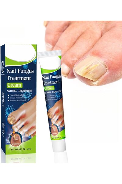HONPOLO Nail Fungus Treatment Cream - 20g Antifungal Nail Repair Ointment for...